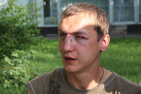 У Києві хлопця побили за українську мову [фото, відео] - фото