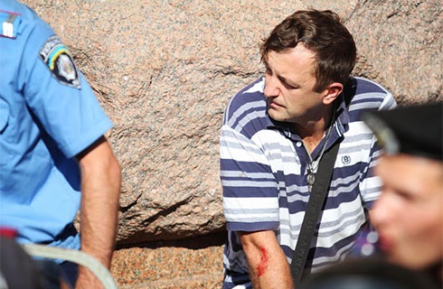 В Київраді «Беркут» побив депутата-свободівця Леонова - фото