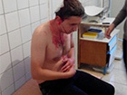 На Житомирщині побили журналіста-борця з «бурштиновою мафією»