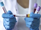 В Україні 16 нових випадків захворювання COVID-19