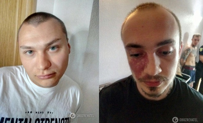 задержанные нападавшие на киборга Дмитрия Вербича, фото 1