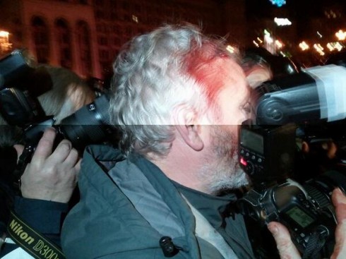 "Беркут" розбив голову фотокореспонденту Reuters Гліба Гаранича - фото