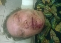 В России избили активистку т.н. «ЛНР» - фото