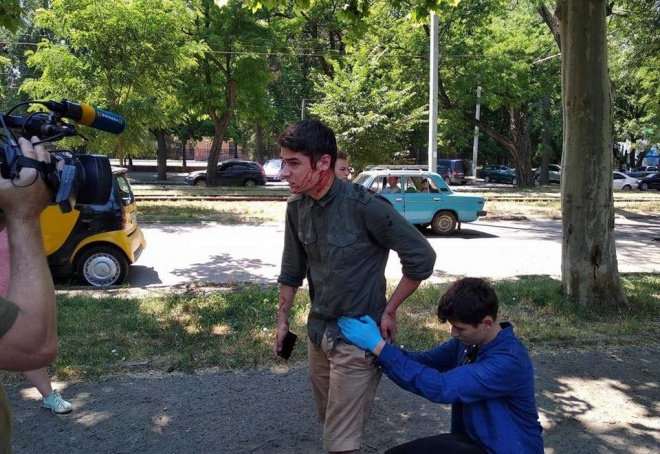 В Одессе с ножом напали на общественного активиста - фото