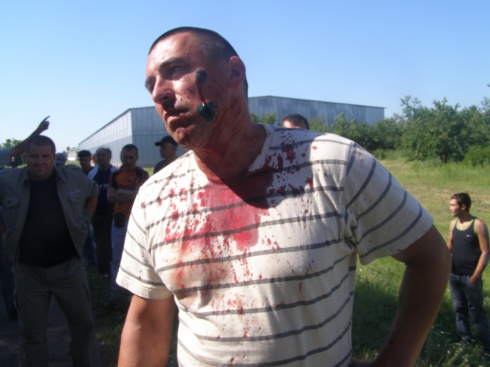 На Миколаївщині бойовики напали на агрофірму, поранено 5 осіб - фото