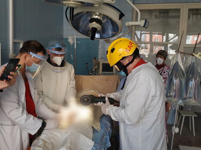 Чоловік насунув гайку на статевий орган — медики звернулися до рятувальників - фото