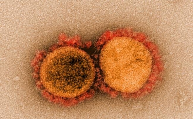 Дельтаподібні варіанти SARS-CoV-2, скоріш за все, посилять серйозність пандемії - фото