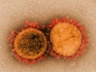 Дельтаподібні варіанти SARS-CoV-2, скоріш за все, посилять серйозність пандемії