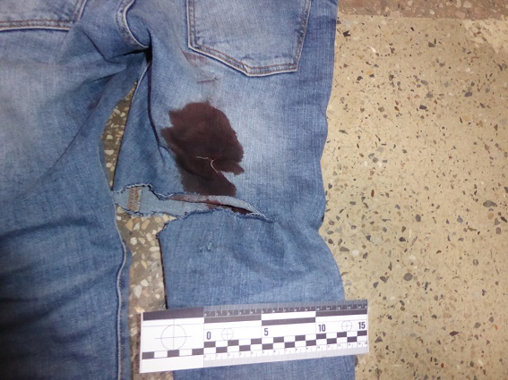 У Києві в чоловіка вистрелили та поранили ножем за те, що заступився за кондуктора, фото 3
