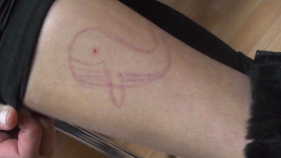 15-річна дівчинка ледь не стала жертвою суїцидальної спільноти Синій кит, фото 1