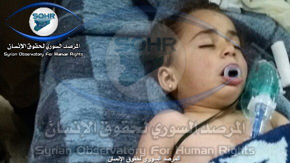 ребенок-жертва химической атаки в Сирии на фото