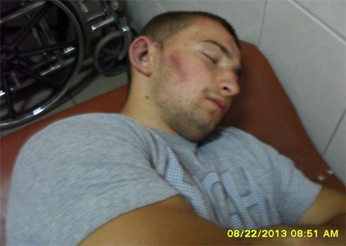 В Черновицкой области милиция применяла пытки? - фото
