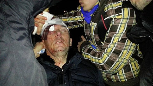 Юрию Луценко милиционеры разбили голову - фото