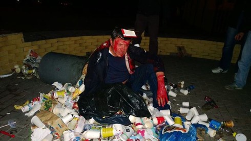 Пилипишина облили красной краской и бросили в мусорник - фото