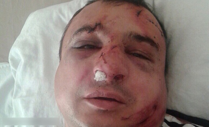 В Киеве избили сепаратиста Клинчаева - фото