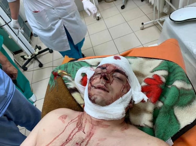 В Конотопе жестоко избили бывшего мэра, «свободовца» Артема Семенихина - фото