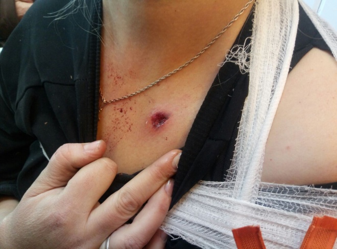 В Марьинке оккупанты ранили гражданского - фото